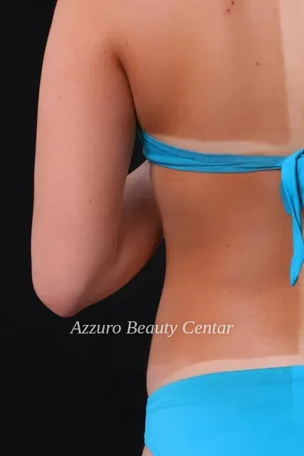 Rezultat airbrush potamnjivanja